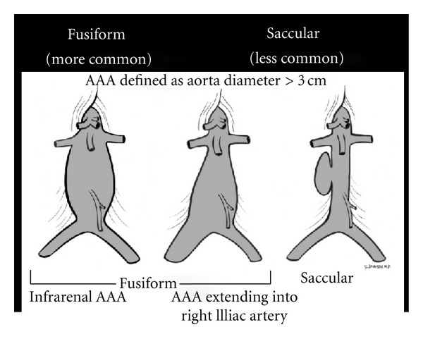 Bedside Ultrasound in Resuscitation and the Rapid Ultrasound in Shock ...