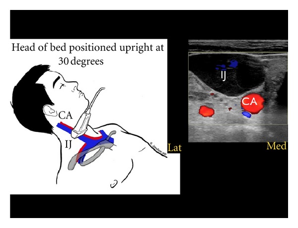 Figure 16