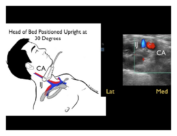 Figure 15