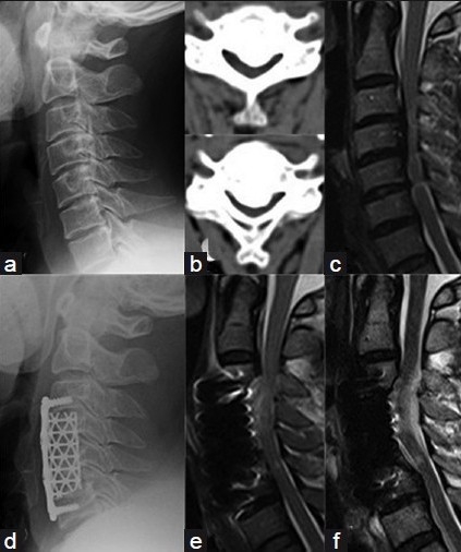 Figure 2A