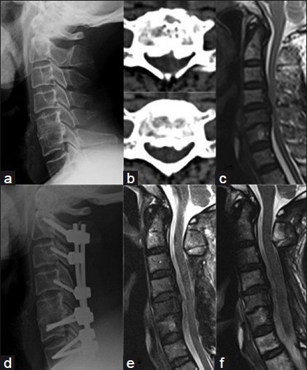 Figure 1A