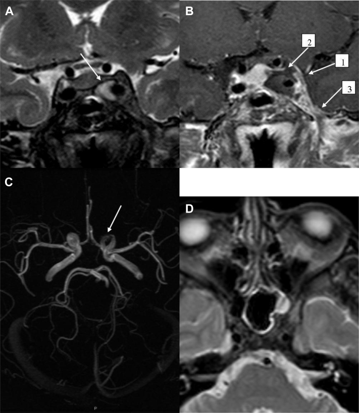 Fig. 3