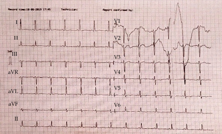 Figure    1 