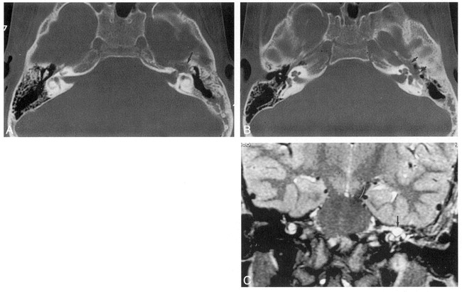 fig 2.