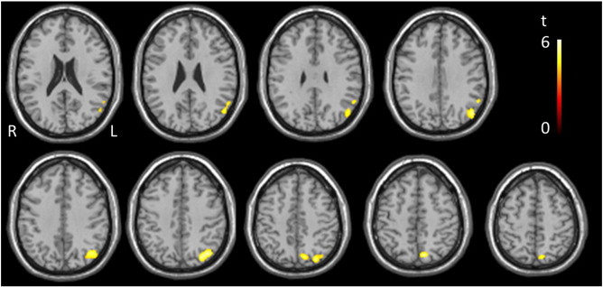 Fig. 2