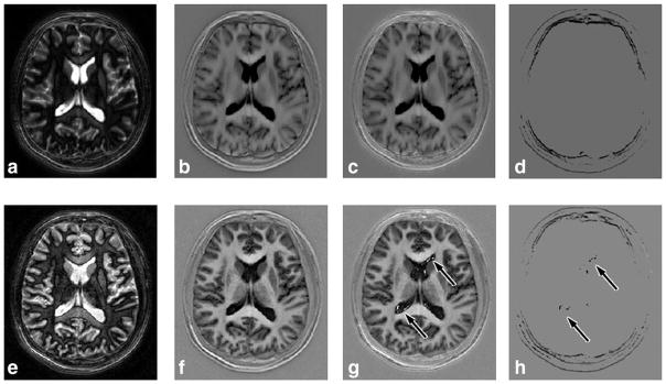 FIG. 8