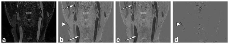 FIG. 7