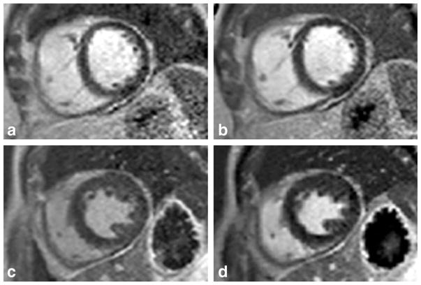 FIG. 6