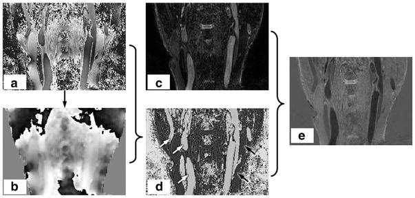 FIG. 3