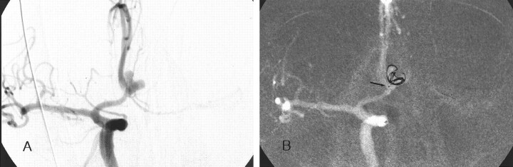 Fig 2.