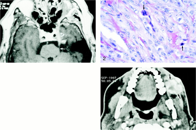 fig 2.