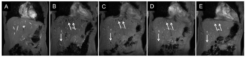 Figure 93: