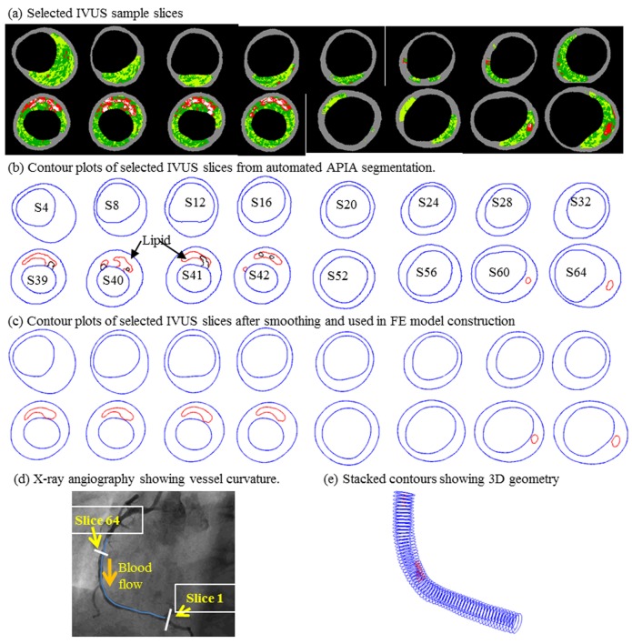 Fig 1