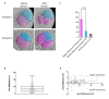 Figure 1.
<b>Analysis of blastomere size and time of division in 2-cell human embryos</b>