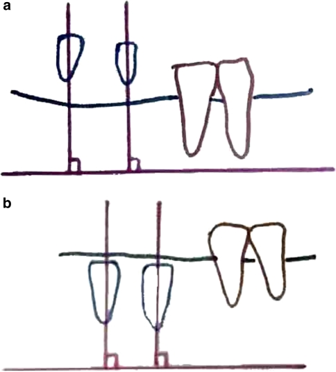 Fig. 6