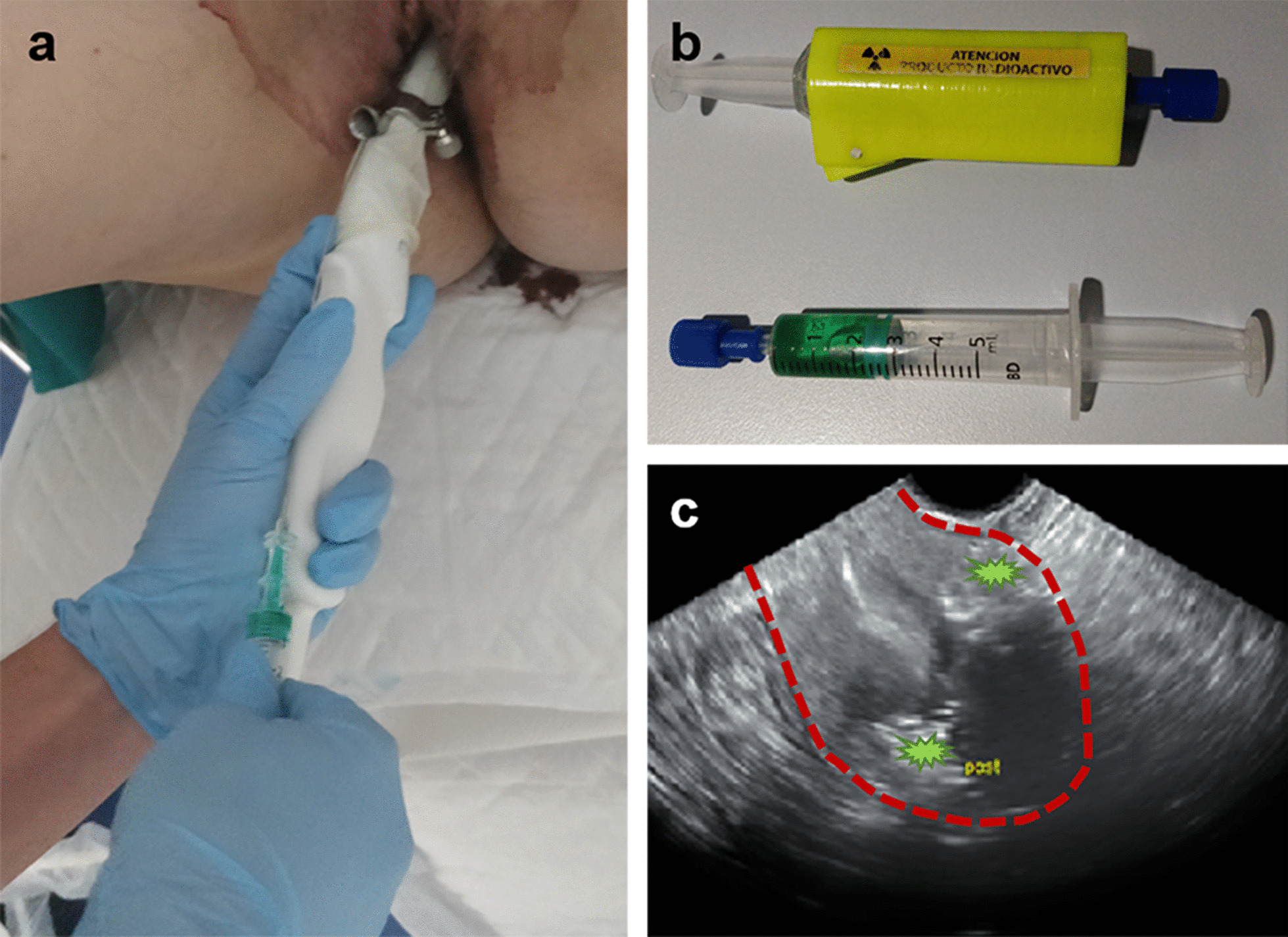 Fig. 1