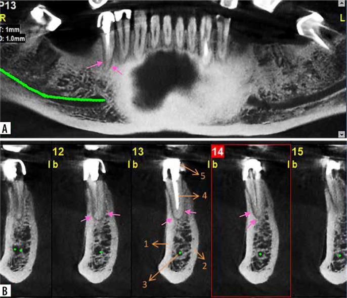 Figure 10