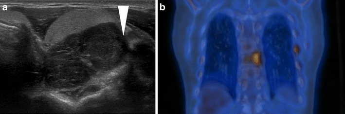 Fig. 11