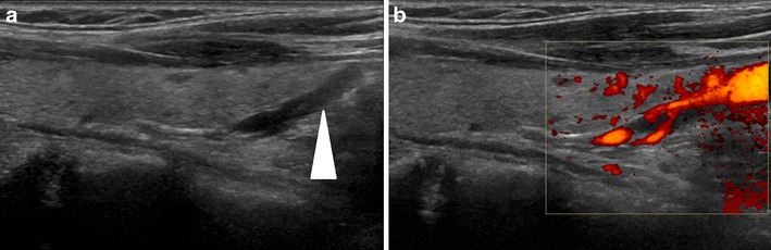 Fig. 9