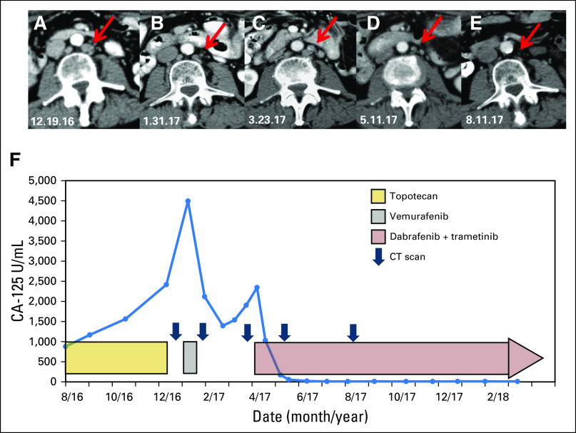 Fig 3.