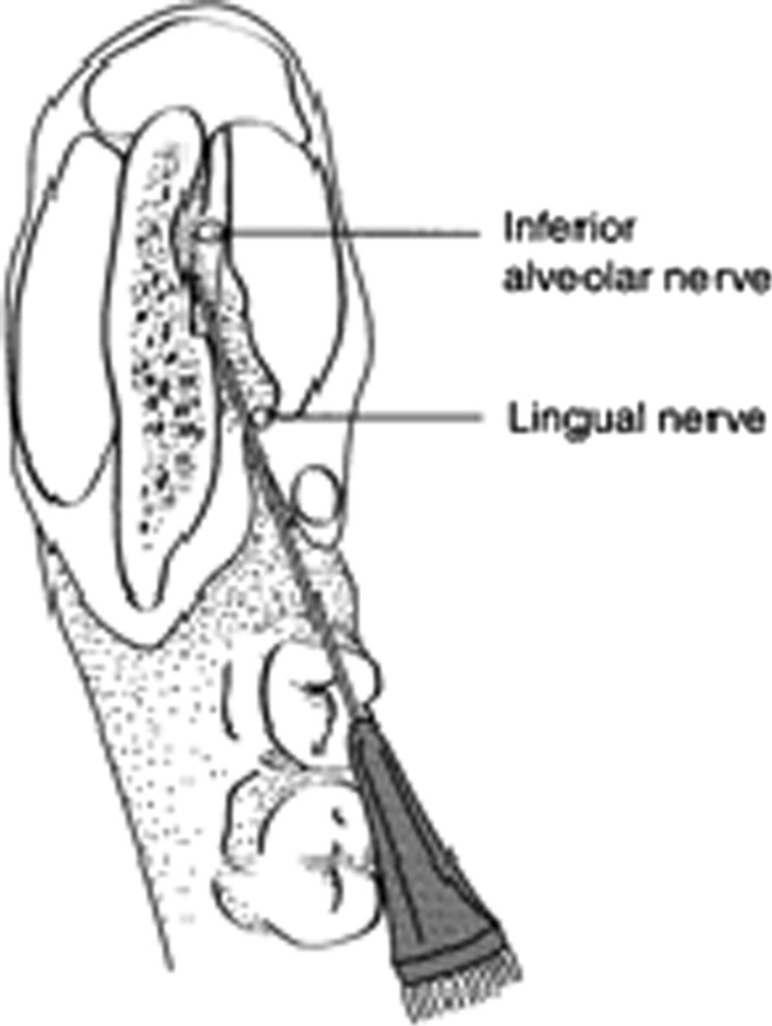 Fig. 1