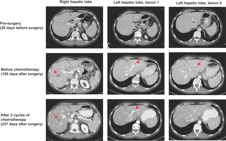 Figure 1