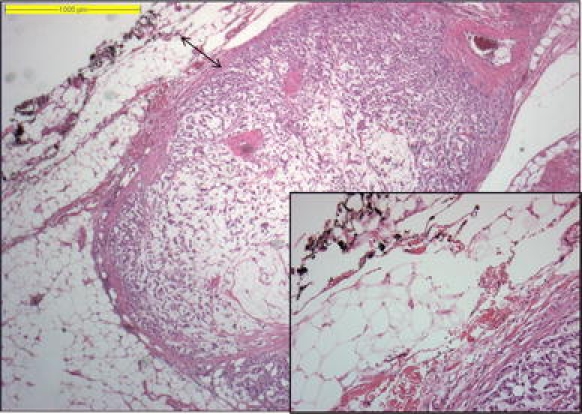 Fig. 2