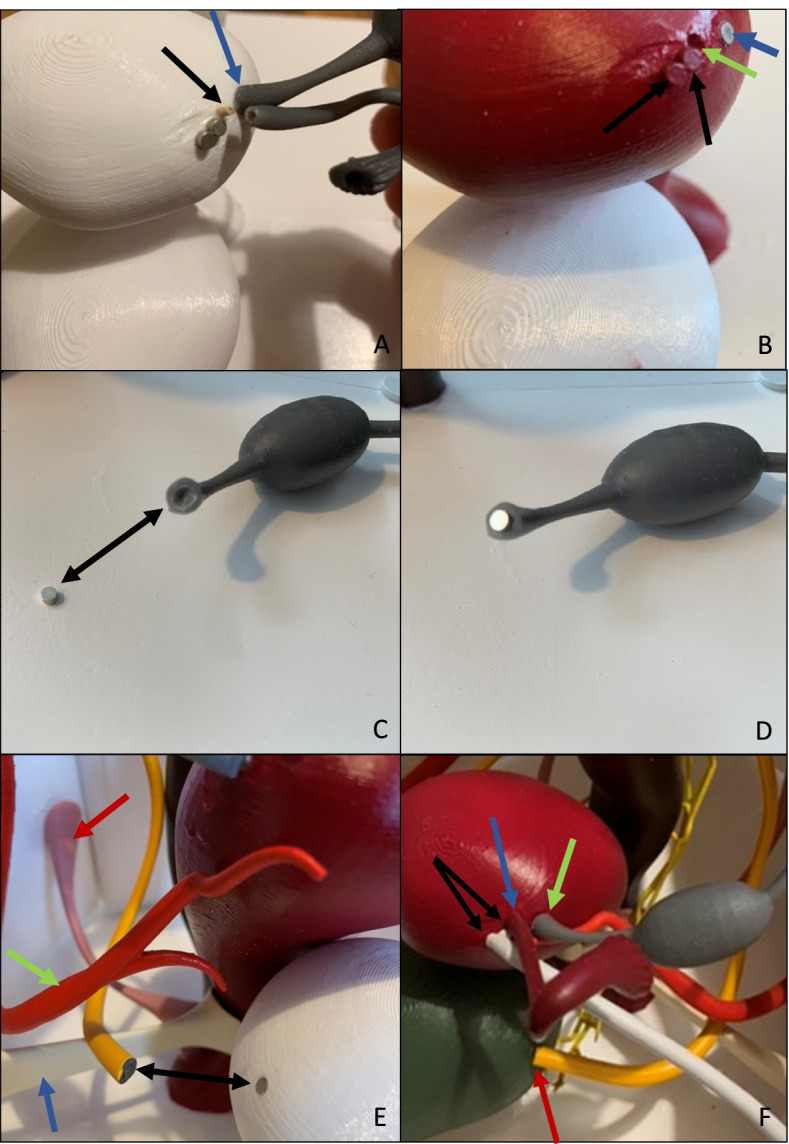 Fig. 11