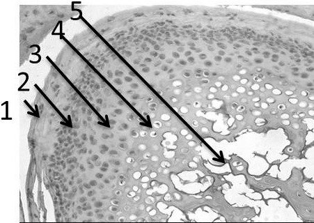 Figure 2. Rat mandibular condyle showing condylar cartilaginous layers for histomorphometric analysis. (1) Fibrocartilage layer. (2) Proliferative layer. (3) Hypertrophic layer. (4) Chondrocyte Layer. (5) Subchondral bone.