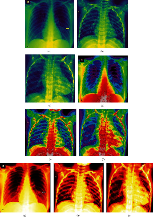 Figure 21