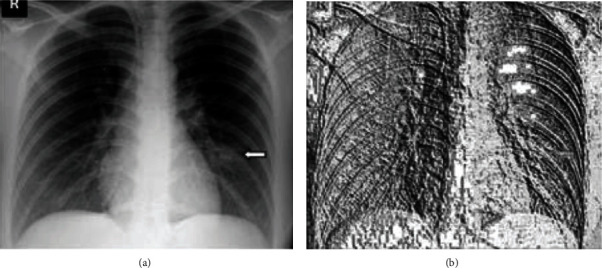 Figure 13