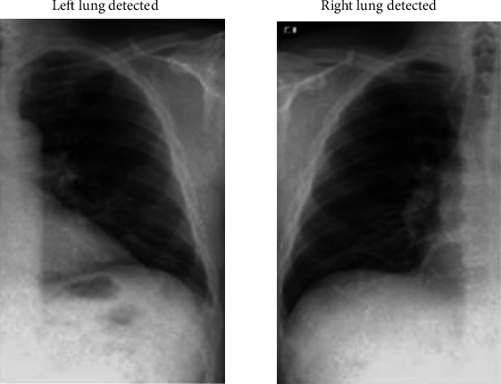 Figure 14