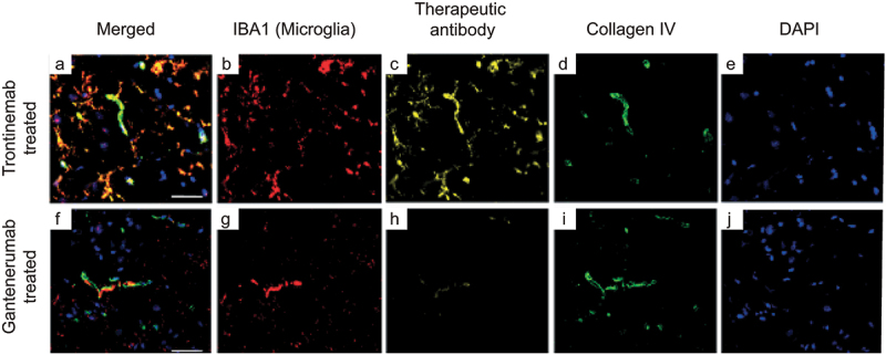 Immunofluorescent images showing the localization of microglia, gantenerumab, vascular basement membrane and nuclei staining in cynomolgus cortex brain sections 24 h after a single IV injection of trontinemab or gantenerumab. At 24 h post-dose, gantenerumab is limited to vasculature, whereas trontinemab is present in the parenchyma in addition to vasculature.