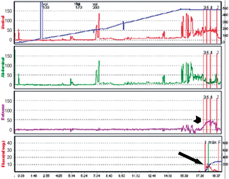 Figure 9a