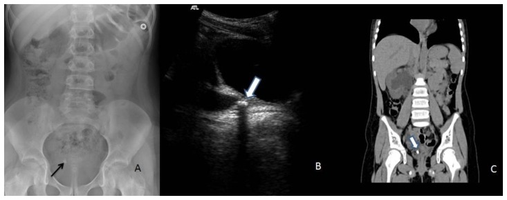 Figure 12