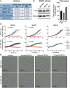 Figure 1. TYK2 inhibitors reduce proliferation in MPNST cells. A, TYK2 protein levels were visualized by IHC in MPNST and plexiform neurofibroma, with positive staining scored on a 0 to 3 scale. B, Relative TYK2 protein levels in MPNST cell lines by WES Western blot analysis. Protein bands analyzed by densitometry, with TYK2 normalized to β-actin. C, JW23.3 and JH-2–002 cells were treated with TYK2 inhibitors (WU-12, WU-76) or inactive control (WU-18) for 3 days, and cell confluence was determined by IncuCyte assay. D, Representative images of IncuCyte assay at 72 hours, with YOYO-1 green fluorescence as indicator of apoptosis.