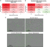 Figure 5. Inhibitors of TYK2 (deucravacitinib) and MEK (mirdametinib) act synergistically to reduce proliferation and increase apoptosis in JW23.3 MPNST cells. Cell confluence and apoptosis was analyzed by the IncuCyte assay after 48 hour incubation with drugs. Synergy was analyzed using Synergy Finder software by the HSA method for (A) inhibition of cell proliferation or (B) apoptosis, and mean synergy score is reported (P < 0.05 vs. drug alone). Intensity of red color indicates synergy score for each dose combination, whereas green indicates antagonism. C, Representative images of JW23.3 cells treated for 48 hours. YOYO-1 green fluorescence indicates apoptotic cells.