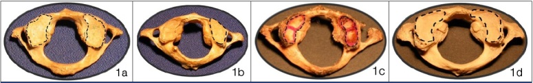 [Table/Fig-1]: