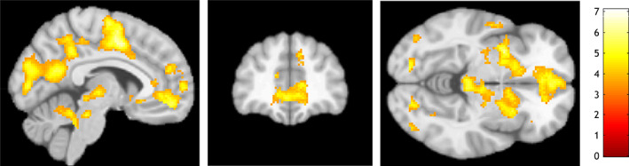 FIGURE 2