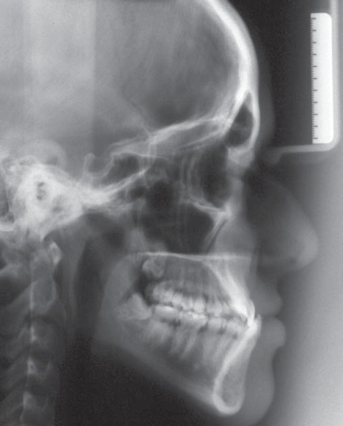 FIGURE 3