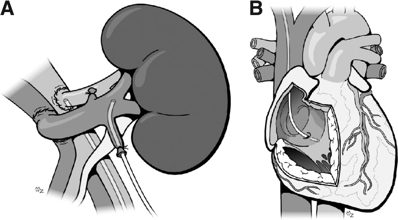 FIG. 1.