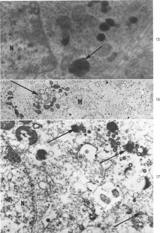 Fig. 15-17