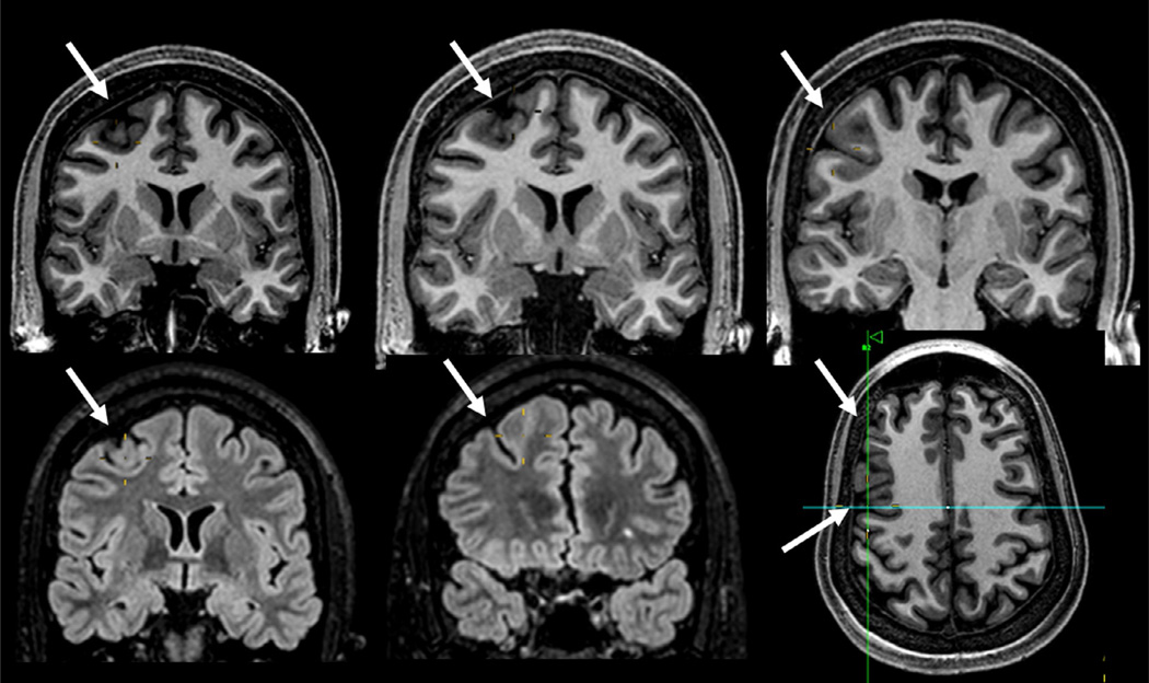 Fig. 51.4