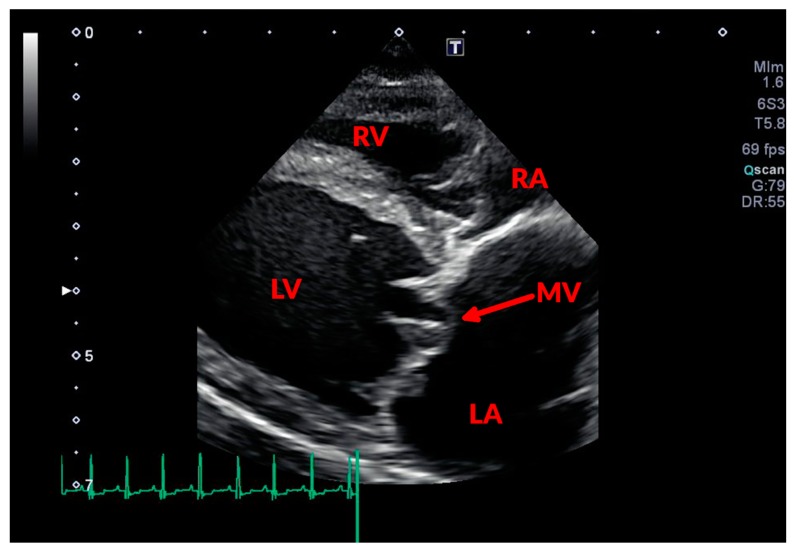 Figure 2