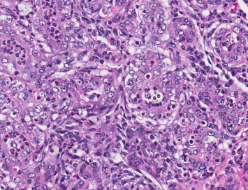 Figure 5.10