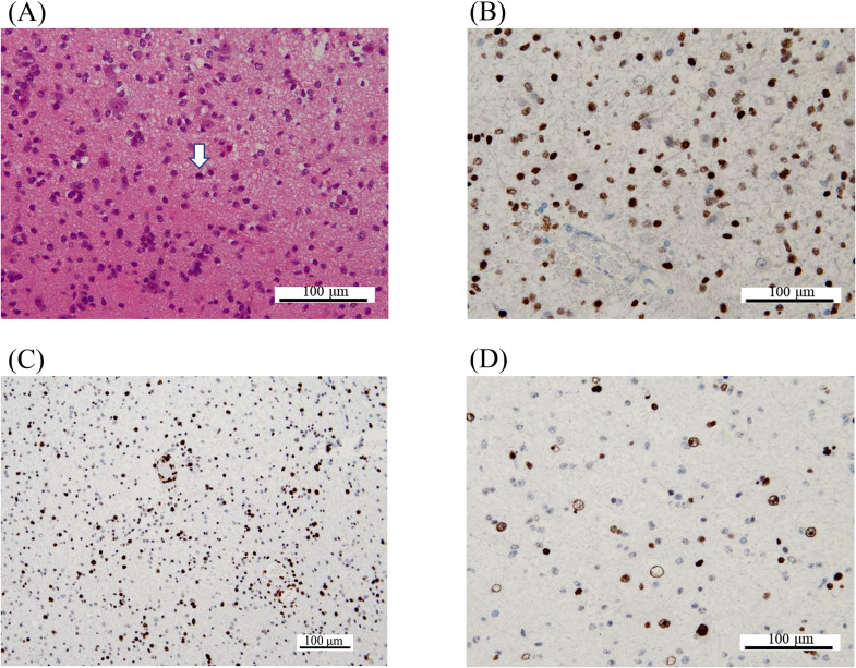 Fig 4