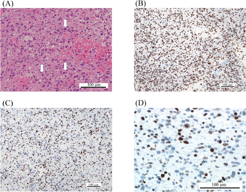 Fig. 2