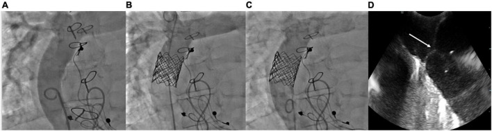 FIGURE 11