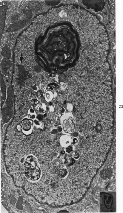 Fig. 22