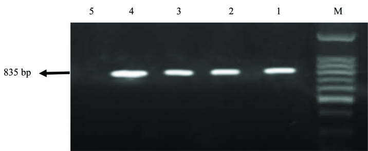 [Table/Fig-4]: